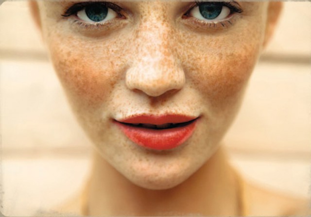 pretty spring skin 640x448 1